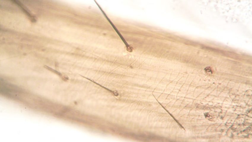 Extreme close-up of plant stem under microscope showing hair structures.